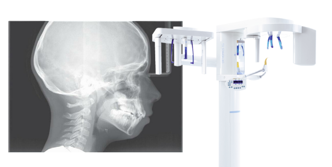 dental x-ray machine-Cephalometric X-Ray Machines